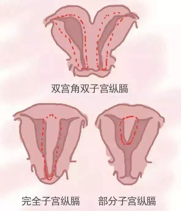 房间装修效果图_房间装修设计图_宝宝房间装修