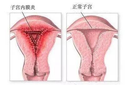 房间装修效果图_房间装修设计图_宝宝房间装修