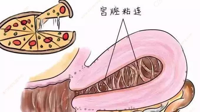 房间装修效果图_房间装修设计图_宝宝房间装修